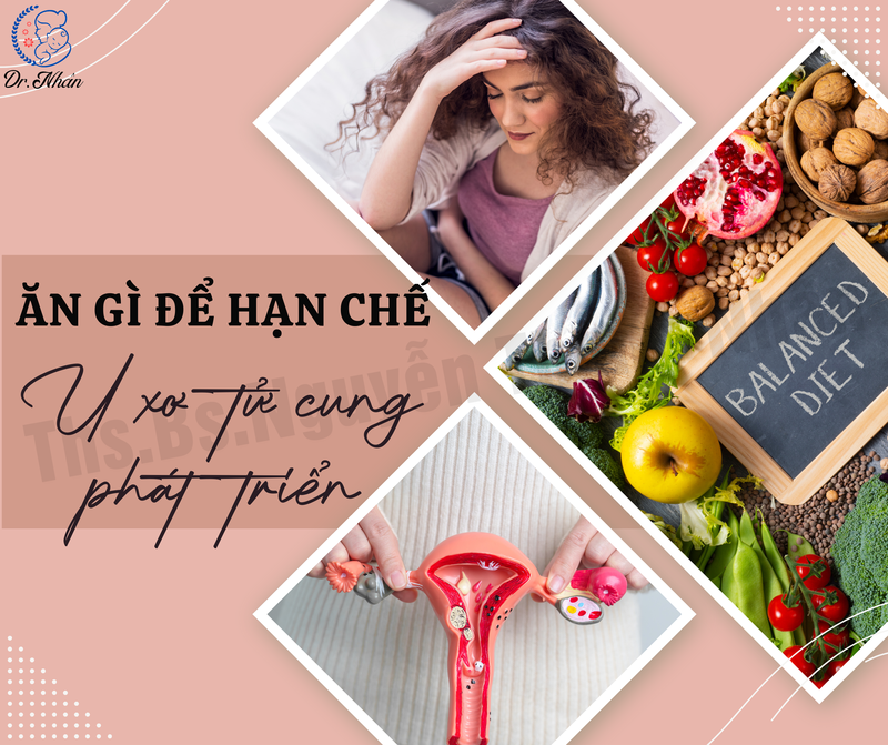 ĂN GÌ ĐỂ HẠN CHẾ U XƠ TỬ CUNG PHÁT TRIỂN
