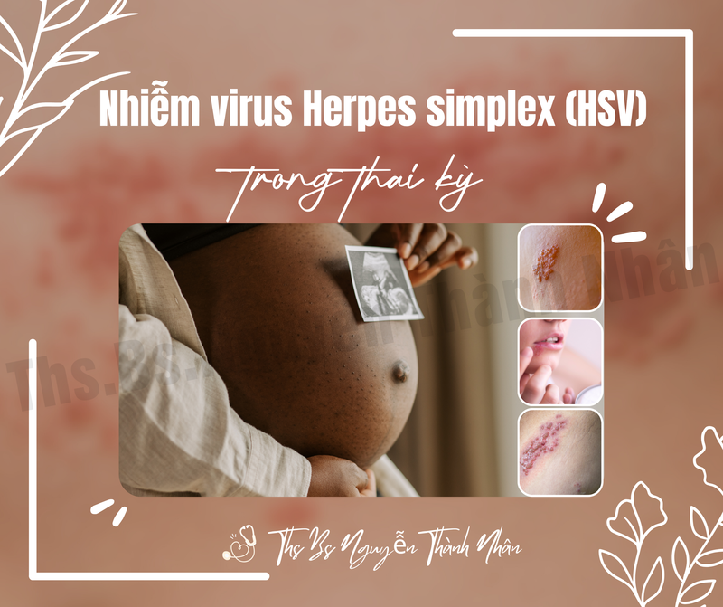 NHIỄM VIRUS HERPES SIMPLEX (HSV) TRONG THAI KỲ