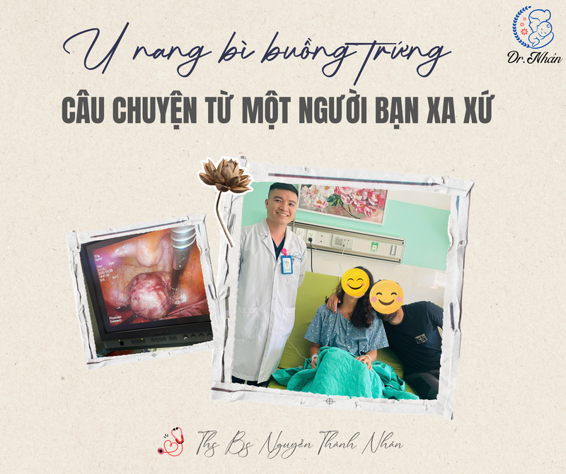 U NANG BÌ BUỒNG TRỨNG – CHUYỆN CỦA NGƯỜI BẠN XA XỨ