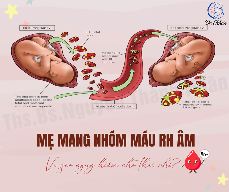 MẸ MANG NHÓM MÁU RH ÂM, VÌ SAO NGUY HIỂM CHO THAI NHI?