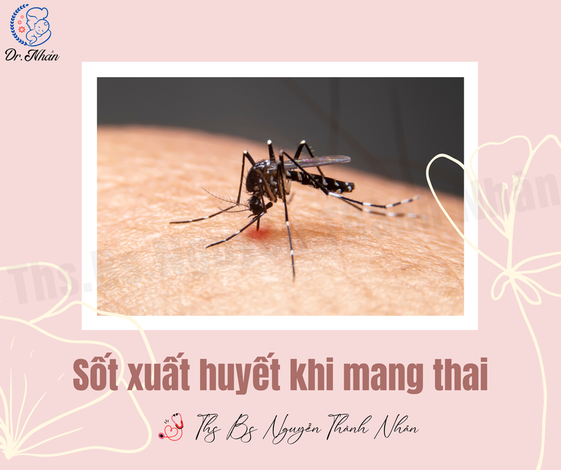 SỐT XUẤT HUYẾT KHI MANG THAI
